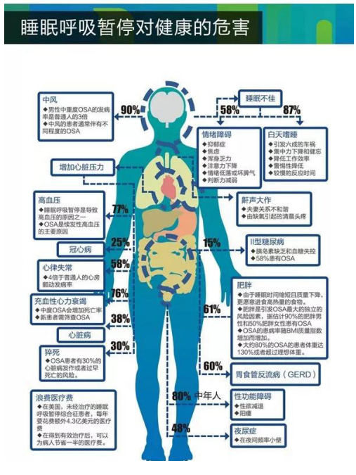 睡眠监测