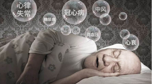 睡眠监测