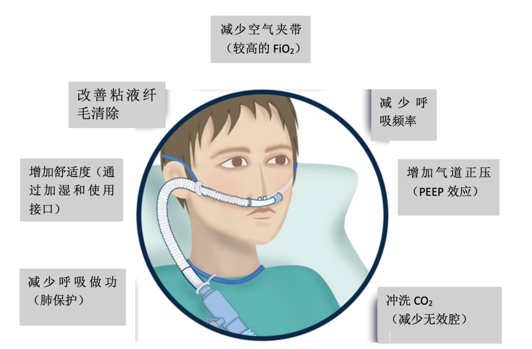 高流量呼吸湿化治疗仪