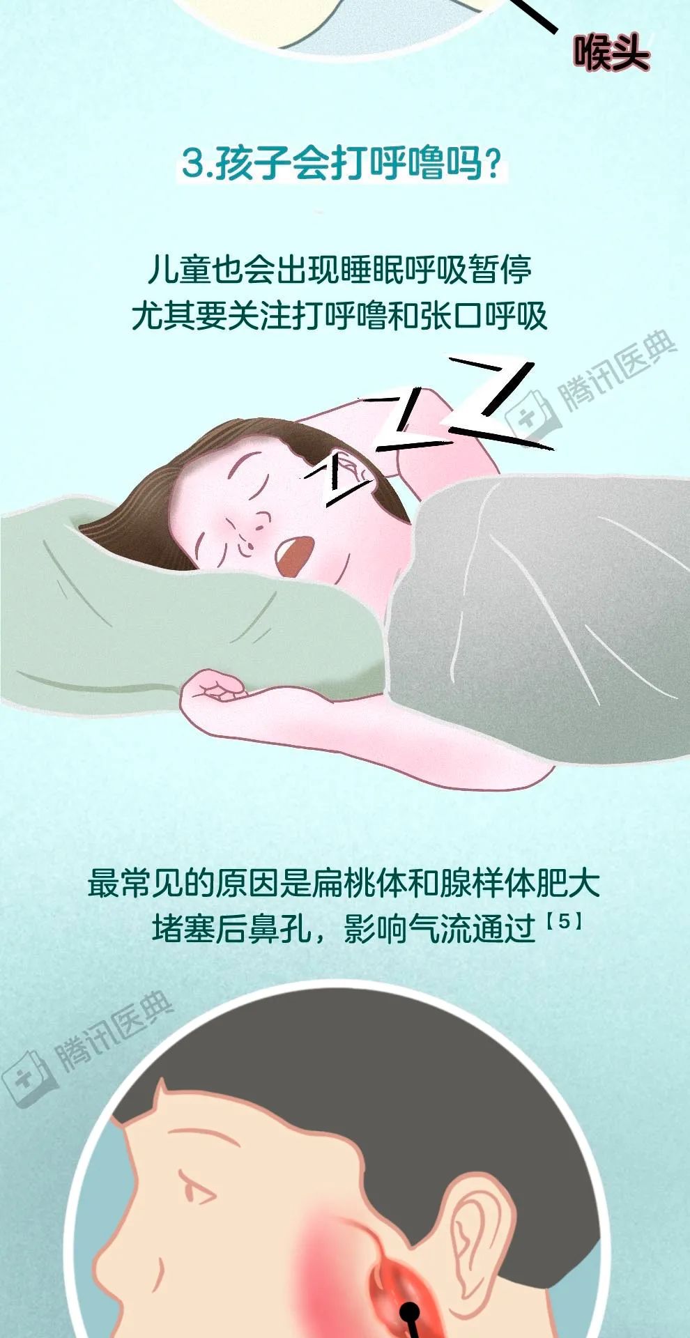 睡眠监测