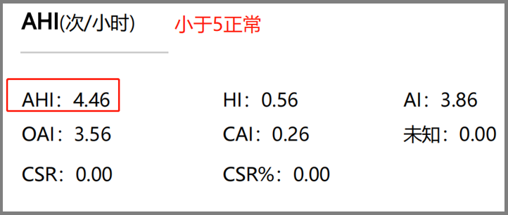 无创呼吸机