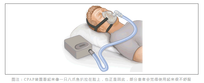 无创呼吸机,高流量呼吸湿化治疗仪,睡眠监测