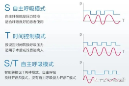 无创呼吸机,高流量呼吸湿化治疗仪,睡眠监测
